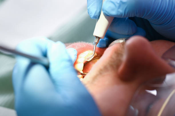 Best Emergency Treatment for Oral Infections in Crestline, CA
